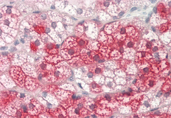 KIF5B Rabbit Polyclonal Antibody