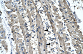 KIF5B Rabbit Polyclonal Antibody