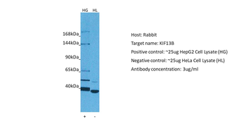 KIF13B Rabbit Polyclonal Antibody