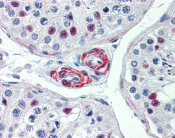 KIF13B Rabbit Polyclonal Antibody