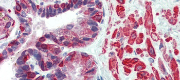 KIF13B Rabbit Polyclonal Antibody