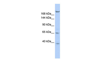 KIF13B Rabbit Polyclonal Antibody
