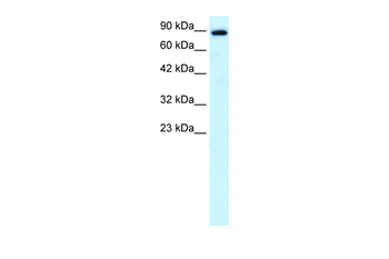 KIF21A Rabbit Polyclonal Antibody
