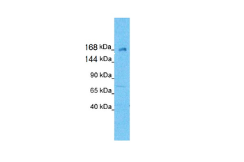 KIF21A Rabbit Polyclonal Antibody