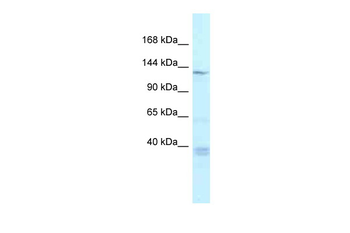 Tnks Rabbit Polyclonal Antibody