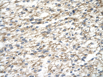 PARP12 Rabbit Polyclonal Antibody