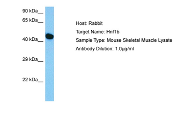 HNF1B Rabbit Polyclonal Antibody
