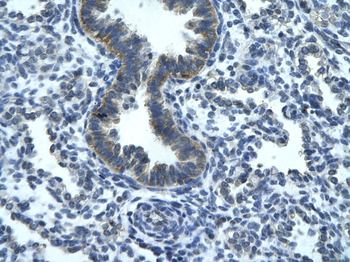 RGS19 Rabbit Polyclonal Antibody