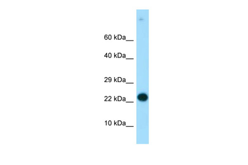 RGS19 Rabbit Polyclonal Antibody