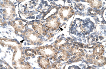 RGS20 Rabbit Polyclonal Antibody
