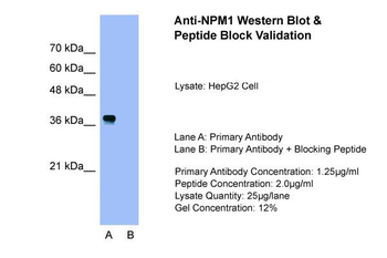 NPM1 Rabbit Polyclonal Antibody