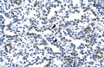 NPM1 Rabbit Polyclonal Antibody