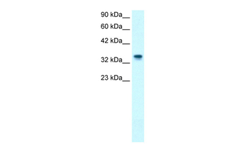 NPM1 Rabbit Polyclonal Antibody