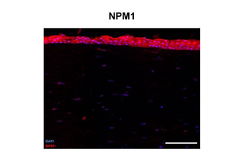 NPM1 Rabbit Polyclonal Antibody