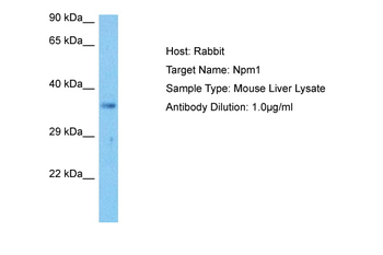 NPM1 Rabbit Polyclonal Antibody