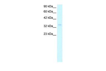 NPM1 Rabbit Polyclonal Antibody