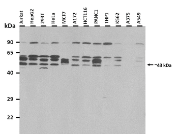 PTGER3 Rabbit Polyclonal Antibody