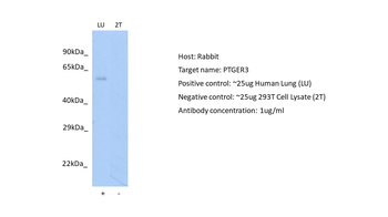 PTGER3 Rabbit Polyclonal Antibody