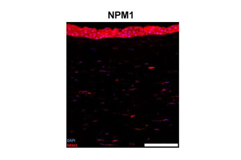 NPM1 Rabbit Polyclonal Antibody