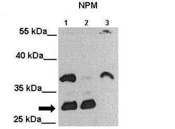 NPM1 Rabbit Polyclonal Antibody