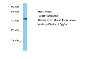 ATF2 Rabbit Polyclonal Antibody