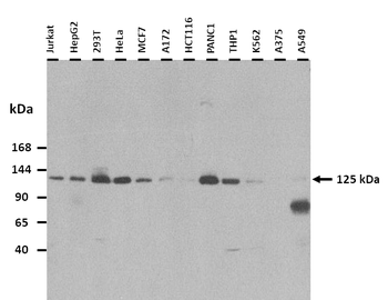ATN1 Rabbit Polyclonal Antibody