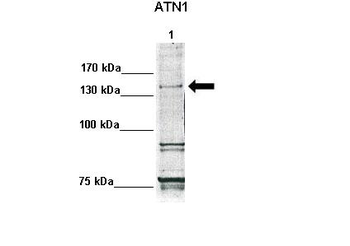 ATN1 Rabbit Polyclonal Antibody