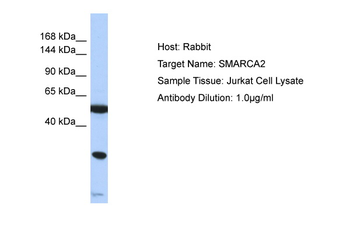 SMARCA2 Rabbit Polyclonal Antibody
