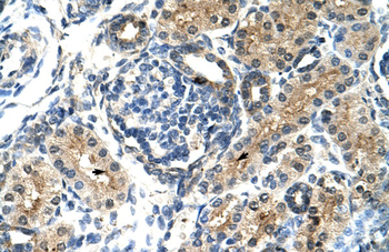TIMELESS Rabbit Polyclonal Antibody