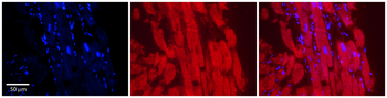 ASPH Rabbit Polyclonal Antibody