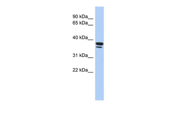 EGR3 Rabbit Polyclonal Antibody
