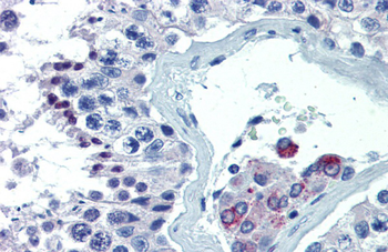 ASH2L Rabbit Polyclonal Antibody