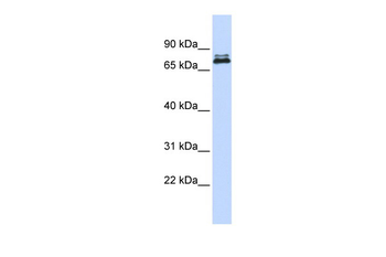 ASH2L Rabbit Polyclonal Antibody