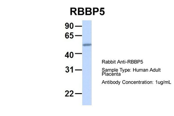 RBBP5 Rabbit Polyclonal Antibody