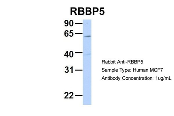 RBBP5 Rabbit Polyclonal Antibody