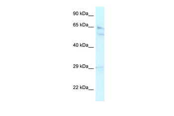 RBBP5 Rabbit Polyclonal Antibody