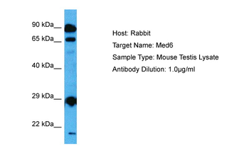 MED6 Rabbit Polyclonal Antibody
