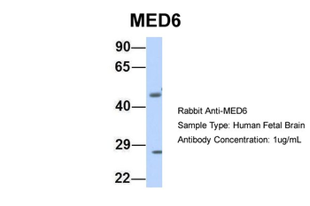 MED6 Rabbit Polyclonal Antibody