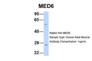 MED6 Rabbit Polyclonal Antibody