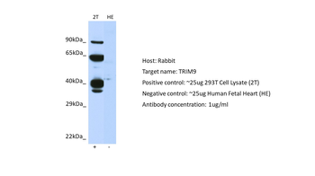 TRIM9 Rabbit Polyclonal Antibody
