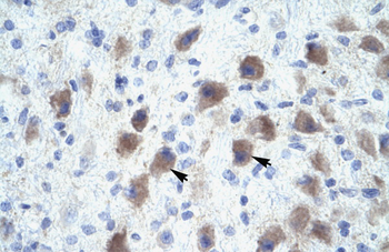 PAX9 Rabbit Polyclonal Antibody