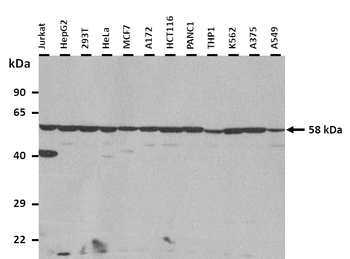 CCT4 Rabbit Polyclonal Antibody
