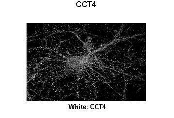 CCT4 Rabbit Polyclonal Antibody