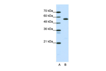 CORO1A Rabbit Polyclonal Antibody