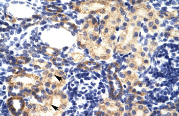 RNF2 Rabbit Polyclonal Antibody