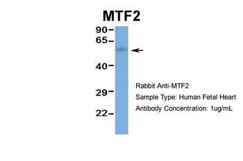 MTF2 Rabbit Polyclonal Antibody