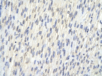 SAP30BP Rabbit Polyclonal Antibody