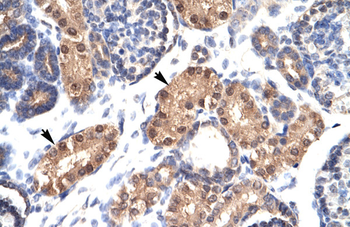 ZFPL1 Rabbit Polyclonal Antibody