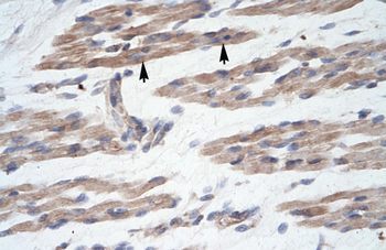 MANSC1 Rabbit Polyclonal Antibody