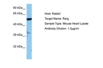 RARG Rabbit Polyclonal Antibody